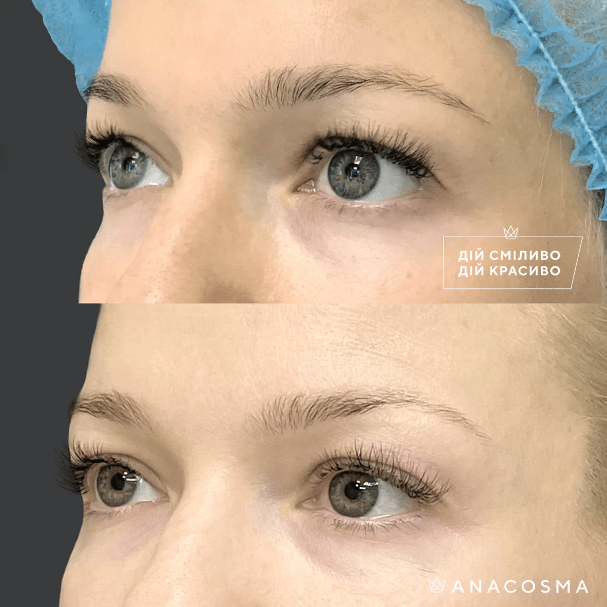 Хусід Ольга Володимирівна до і після - Фото 4