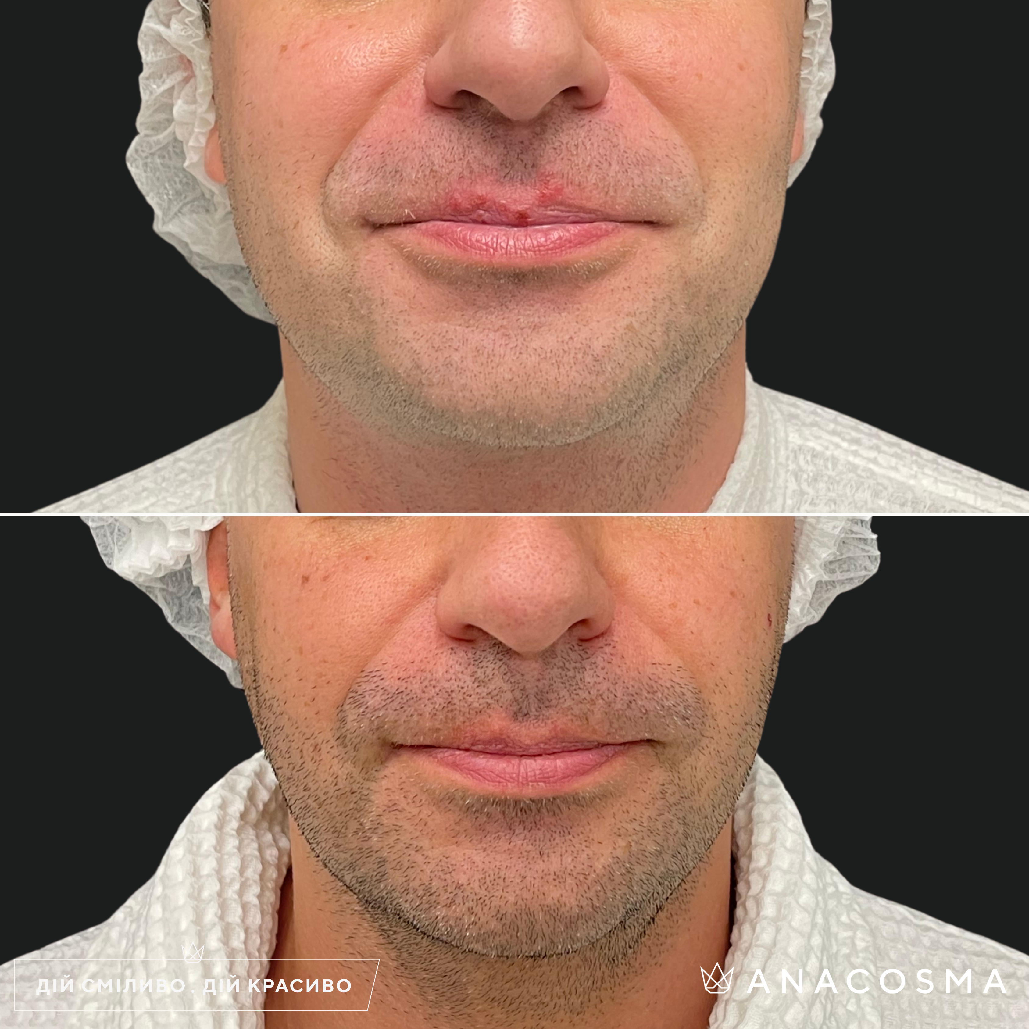 Хусід Ольга Володимирівна до і після - Фото 6