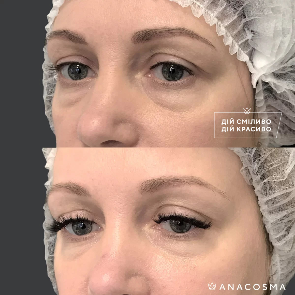 Хусід Ольга Володимирівна до і після - Фото 8