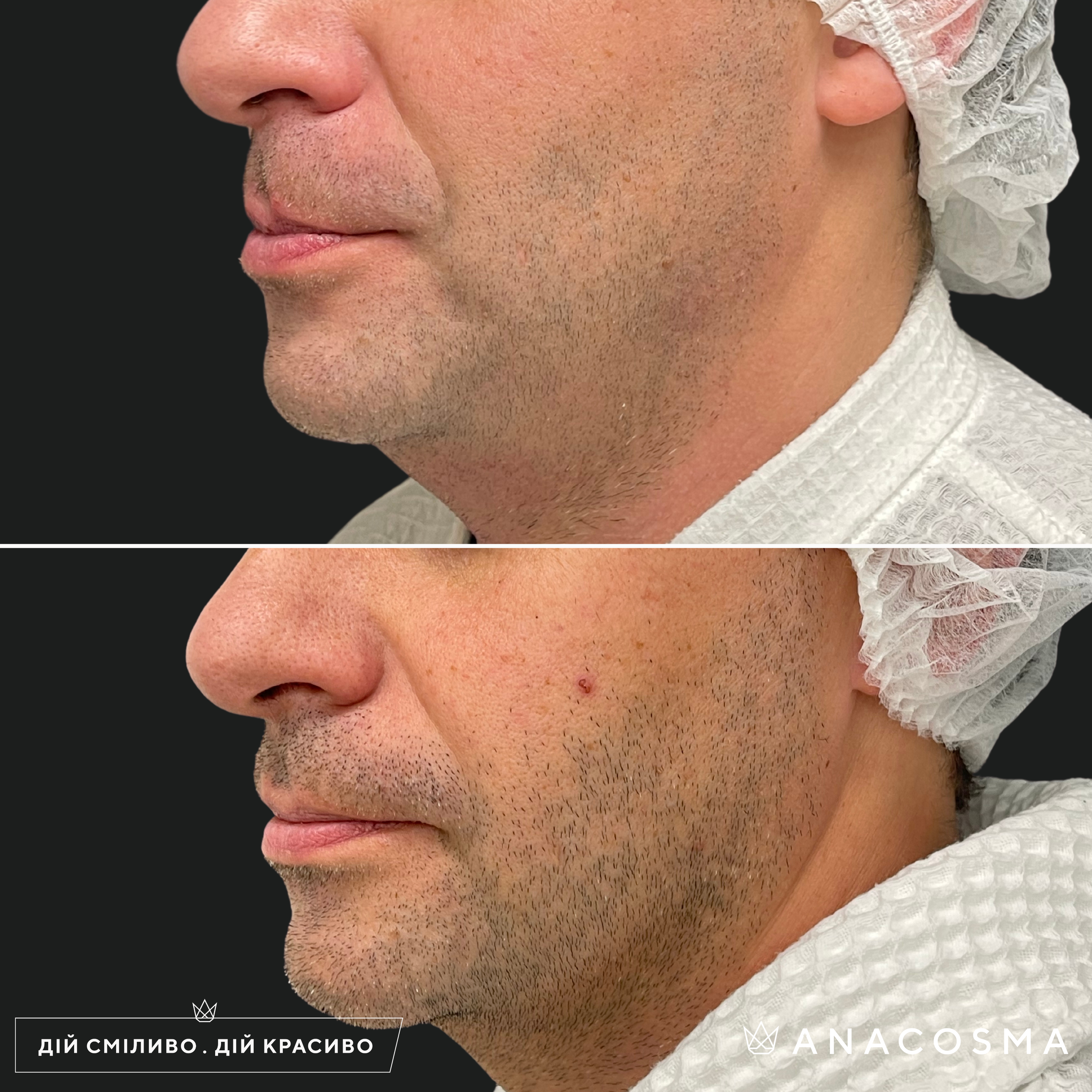 Хусід Ольга Володимирівна до і після - Фото 5