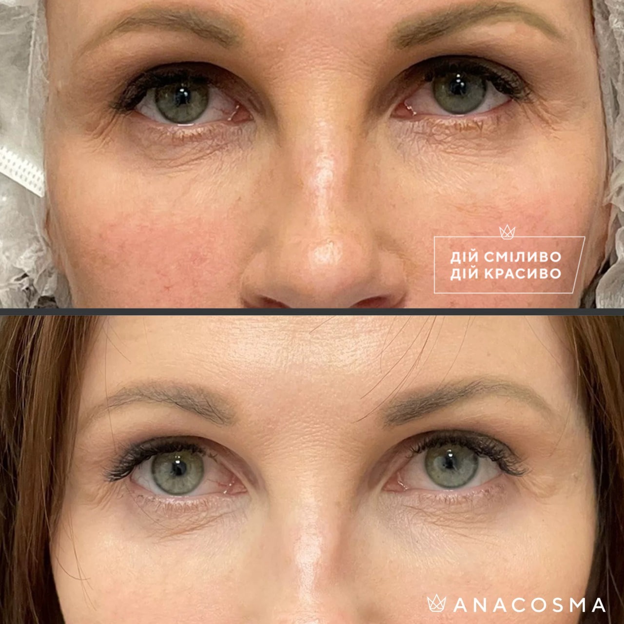 Хусід Ольга Володимирівна до і після - Фото 9