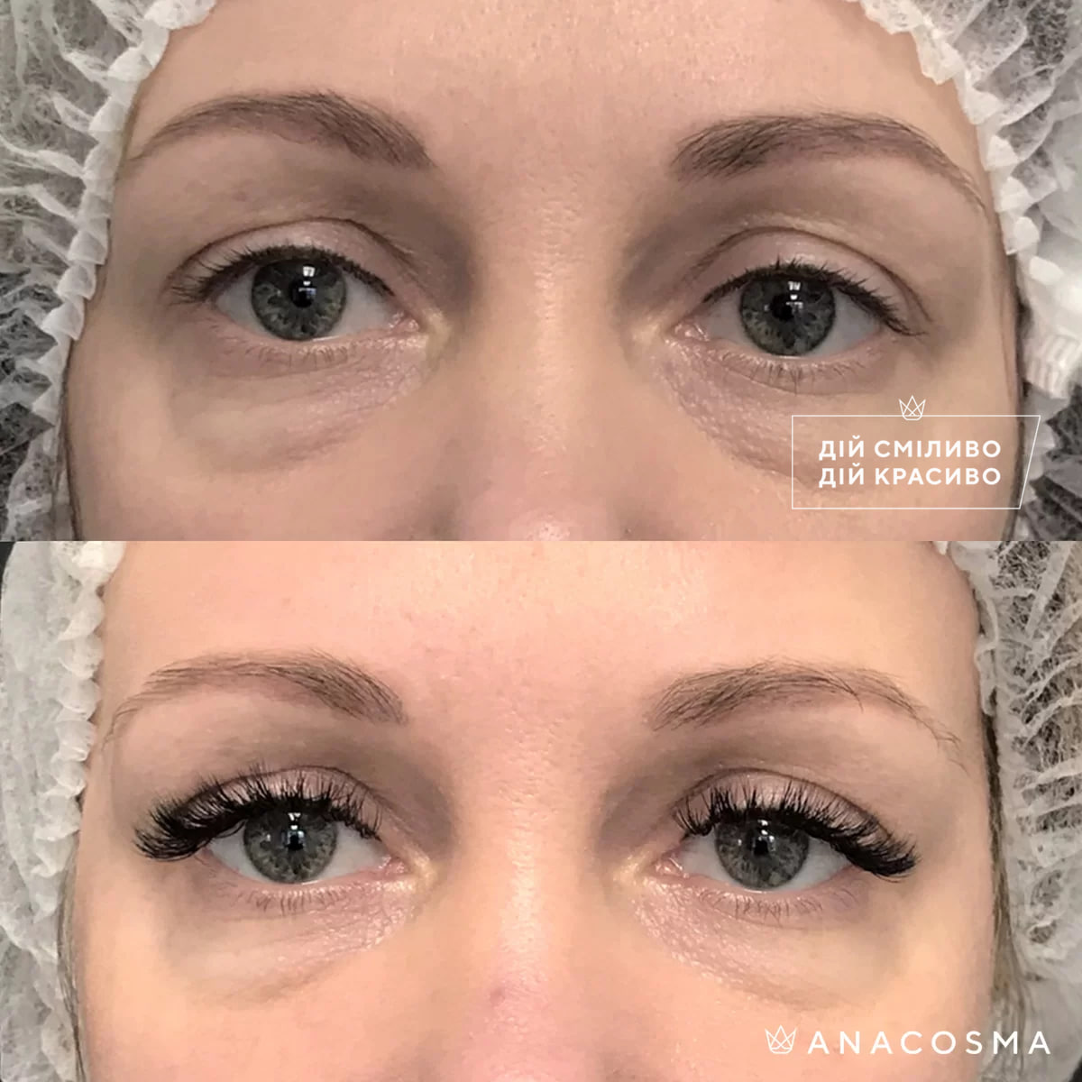 Хусід Ольга Володимирівна до і після - Фото 10