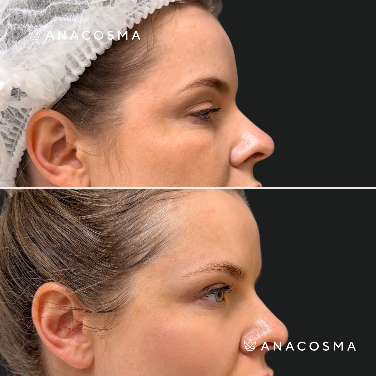 Oksana Makarenko before and after - Photo 1