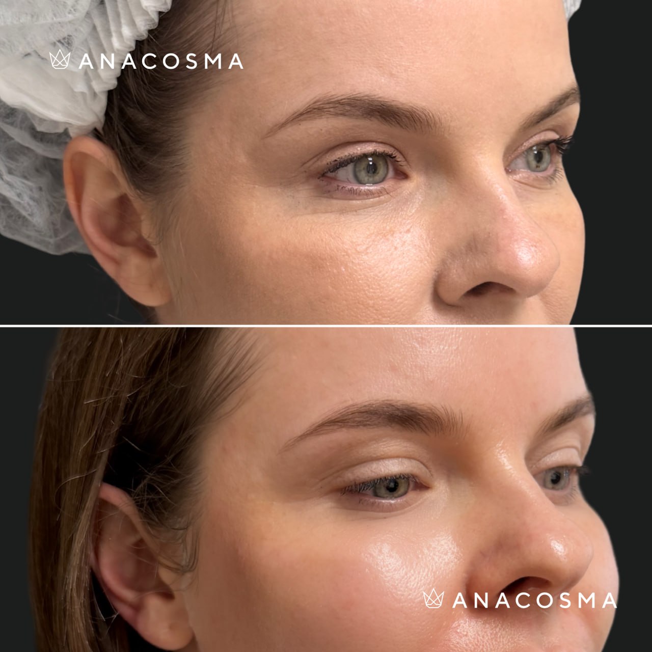 Oksana Makarenko before and after - Photo 2