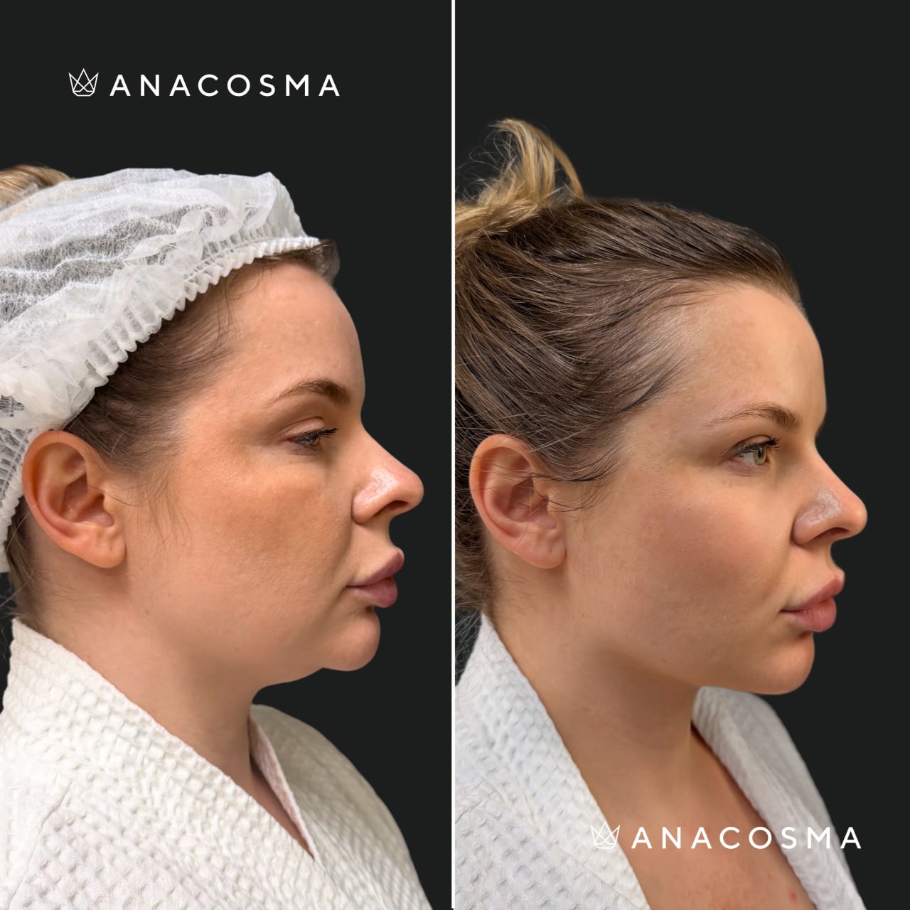 Oksana Makarenko before and after - Photo 3