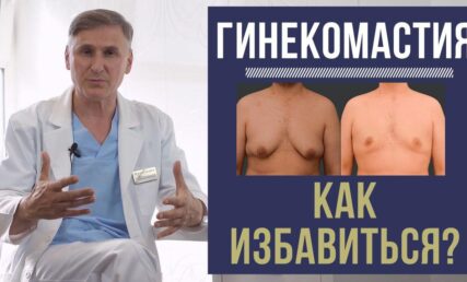Гінекомастія. Як позбавитись?