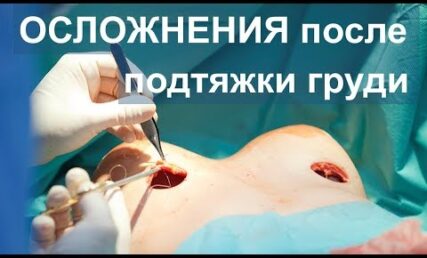 Ускладнення після підтяжки грудей: які вони бувають и що робити, якщо виникли?