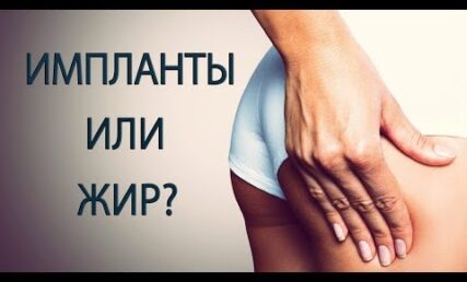 Глютеопластика чи ліпофілінг: чим краще збільшити попу: власним жиром чи імплантами?