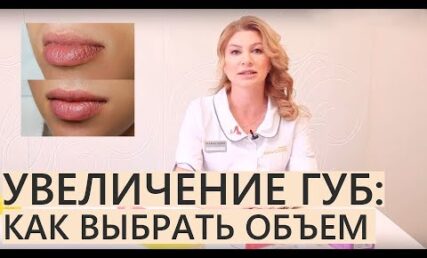 💋ЗБІЛЬШЕННЯ ГУБ: 💋 скільки потрібно мл гіалуронки в губи? 💋