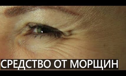 Як позбутися зморшок на обличчі? Найбільш інноваційна процедура - бланшинг Белотеро