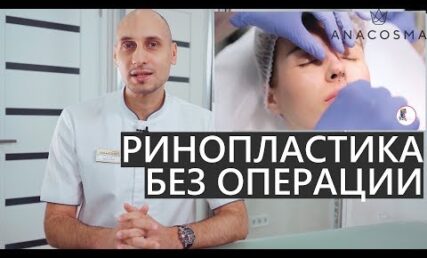 Як вибрати філлер для безопераційної ринопластики? Розповідає Тарас Баранов, пластичний хірург клініки ANACOSMA