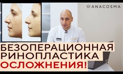 Ускладнення після безопераційної ринопластики та як їх уникнути