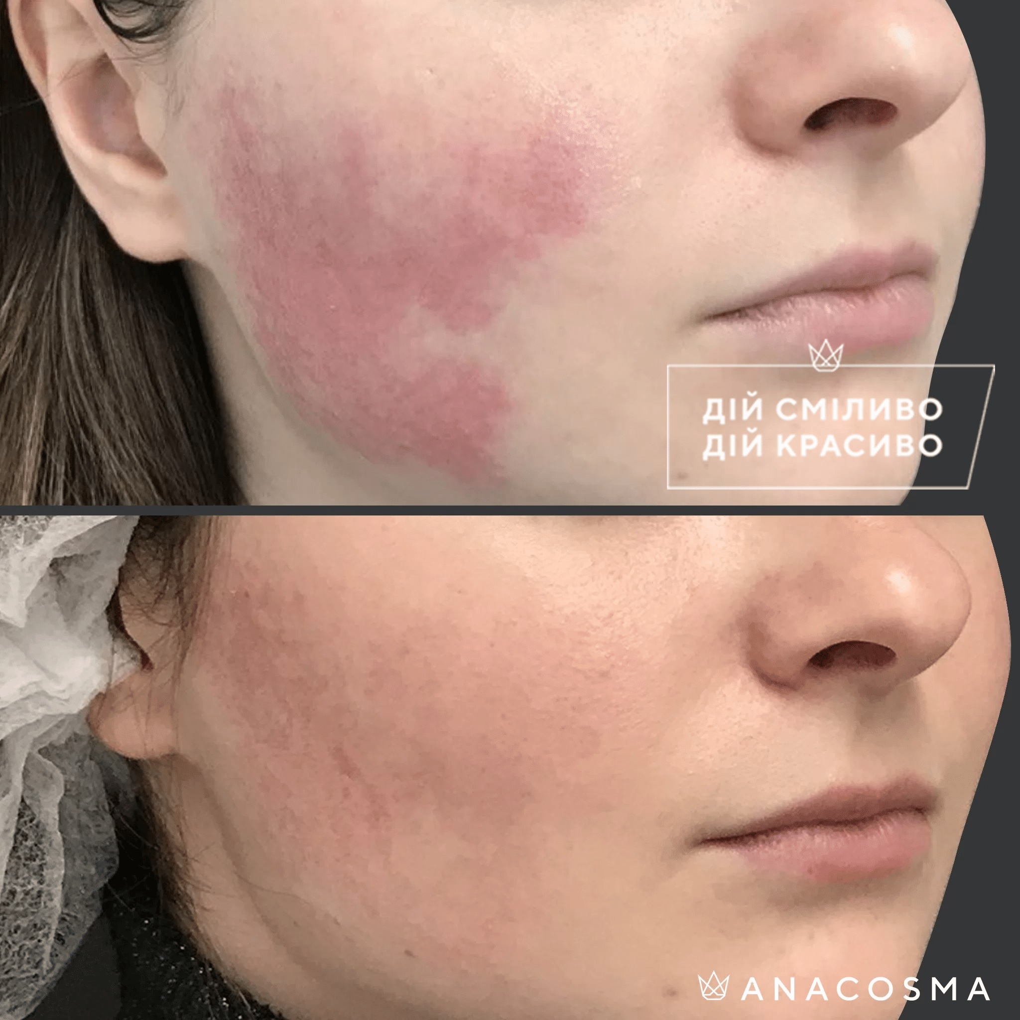 Хусід Ольга Володимирівна до і після - Фото 1