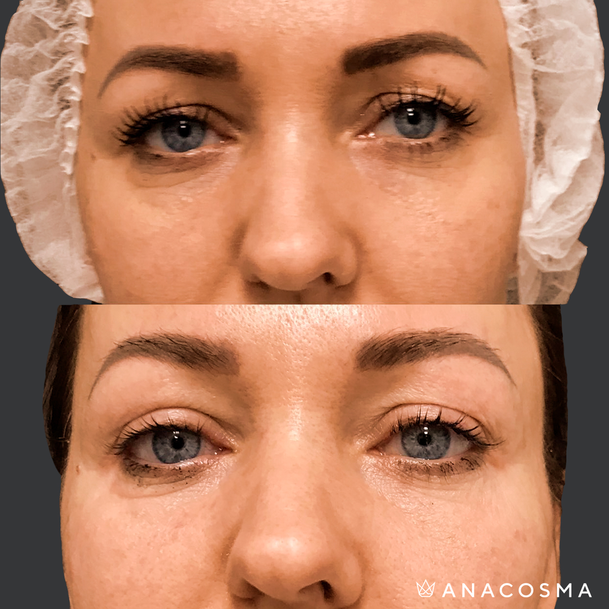 Хусід Ольга Володимирівна до і після - Фото 1