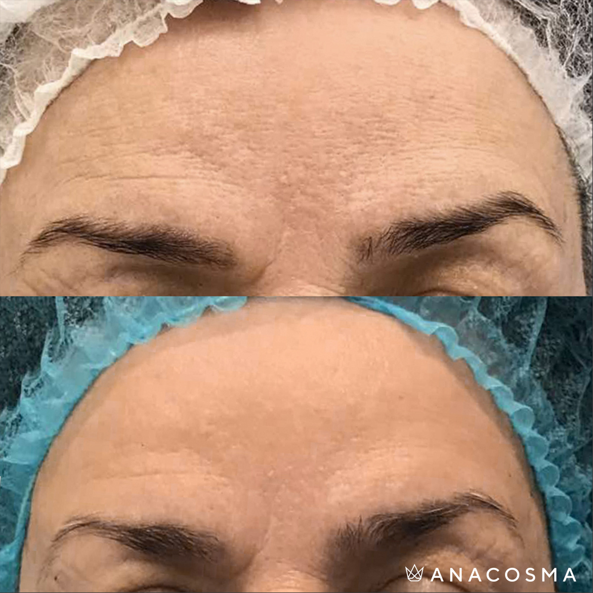 Хусід Ольга Володимирівна до і після - Фото 1