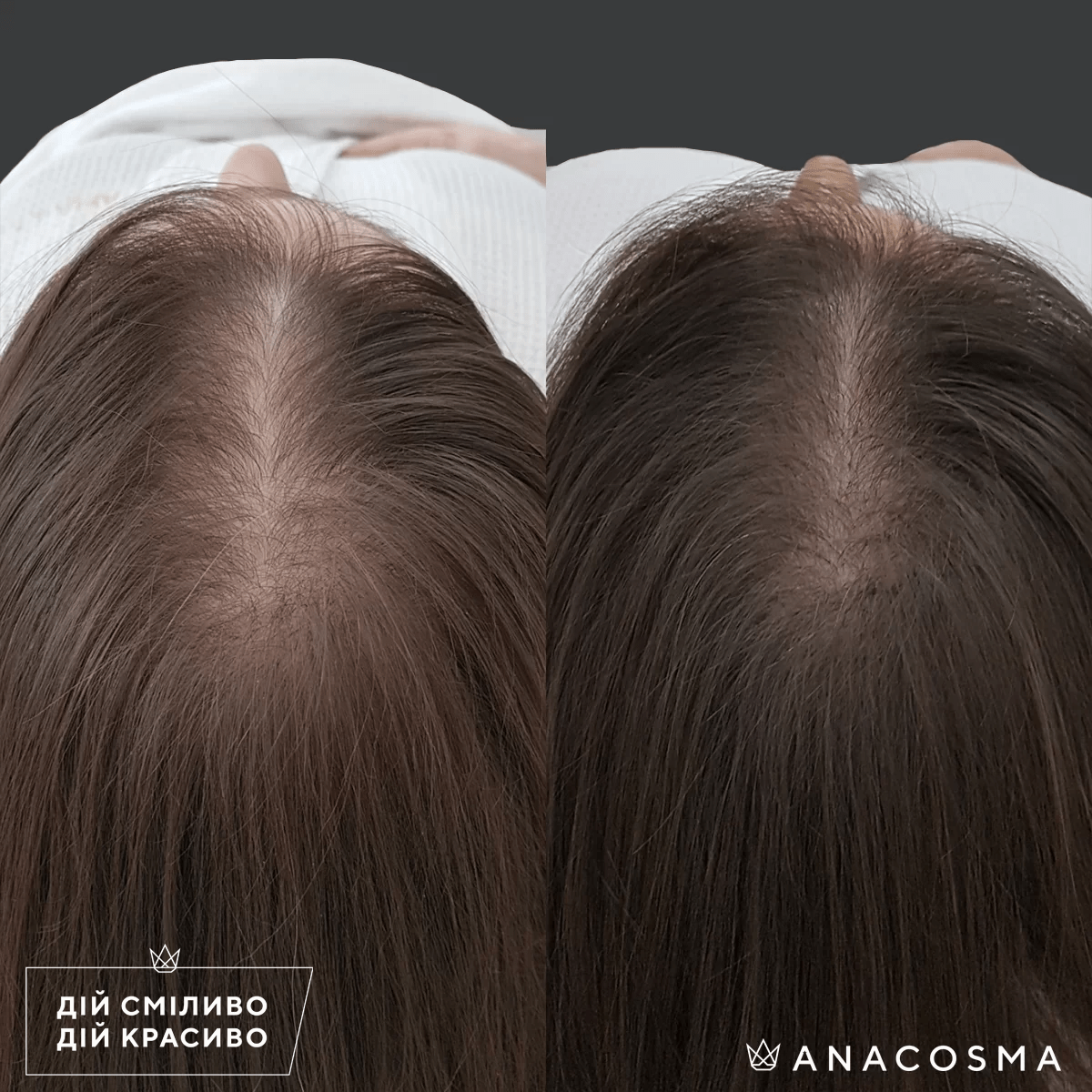 Лікування волосся до і після - Фото 1