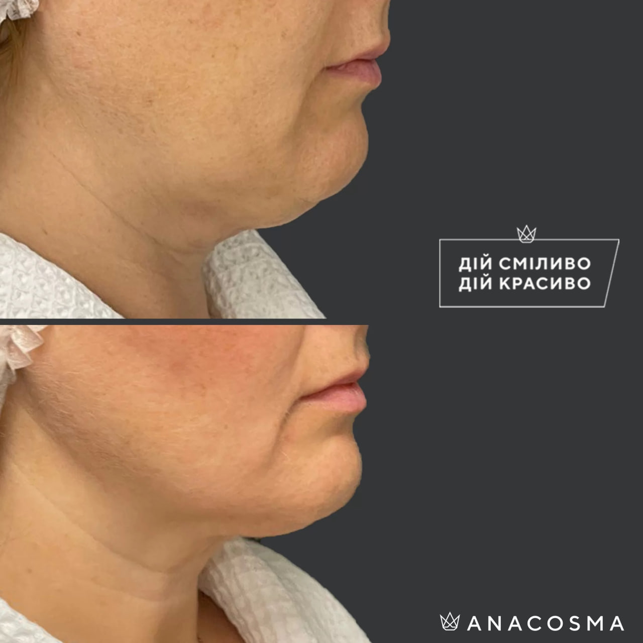 Хусід Ольга Володимирівна до і після - Фото 1