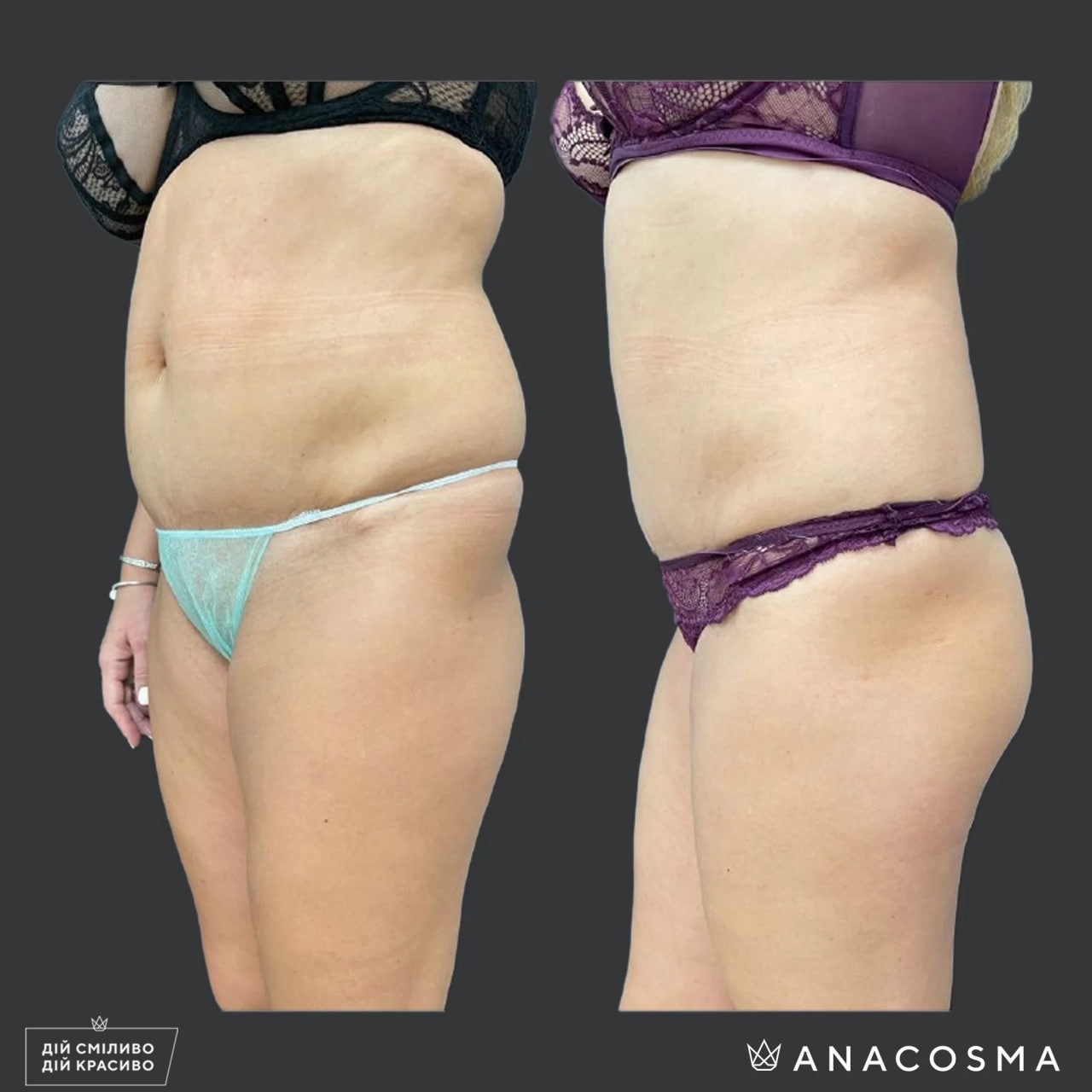 Хусід Ольга Володимирівна до і після - Фото 2