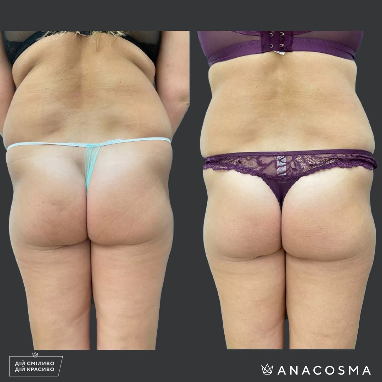 Хусід Ольга Володимирівна до і після - Фото 1