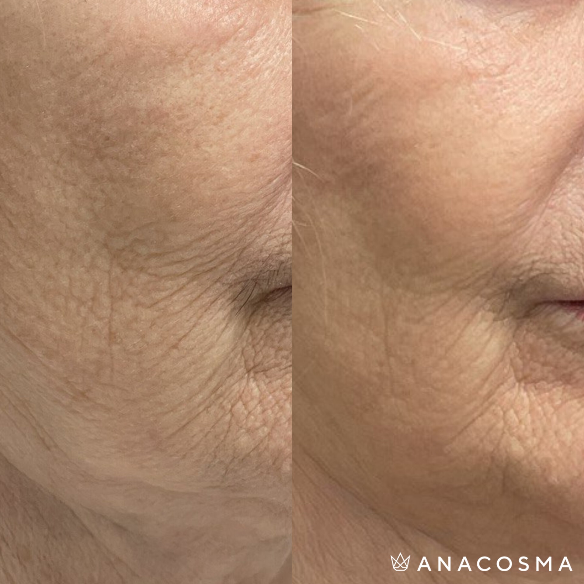 Хусід Ольга Володимирівна до і після - Фото 2