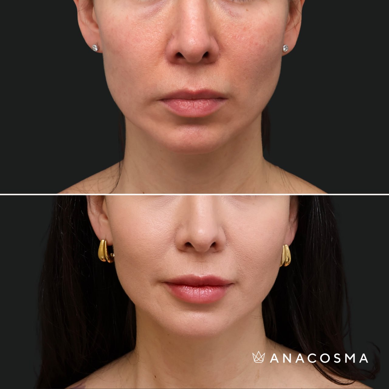 Taras Baranov before and after - Photo 3