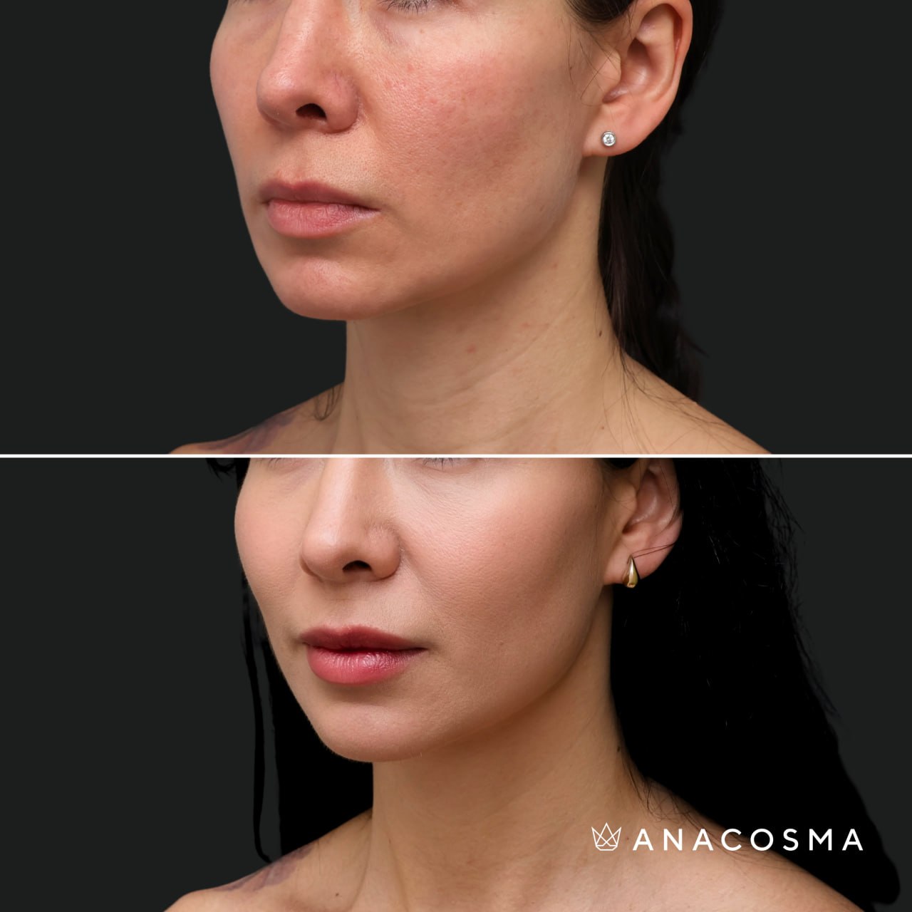 Taras Baranov before and after - Photo 4