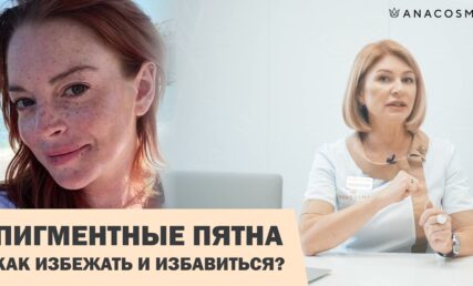 Пігментні плями. Як не допустити їх появи або позбутись нових?