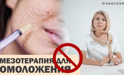 ⛔️ МЕЗОТЕРАПІЯ ДЛЯ ОМОЛОДЖЕННЯ ОБЛИЧЧЯ⁉️🔥ЧИ Є РЕЗУЛЬТАТ⁉️