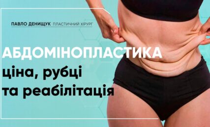 АБДОМІНОПЛАСТИКА. ЦІНА, РУБЦІ ТА РЕАБІЛІТАЦІЯ