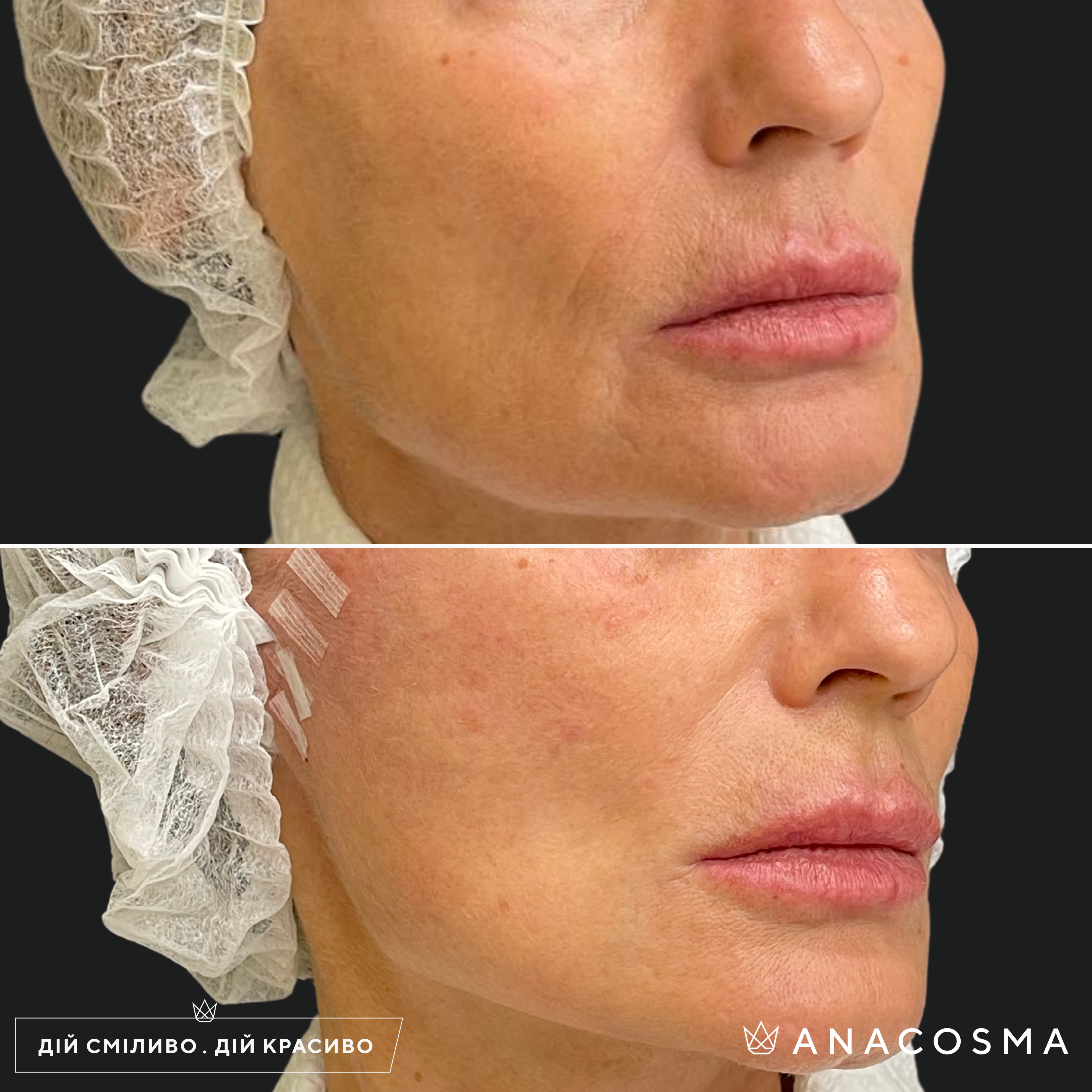 Хусід Ольга Володимирівна до і після - Фото 2