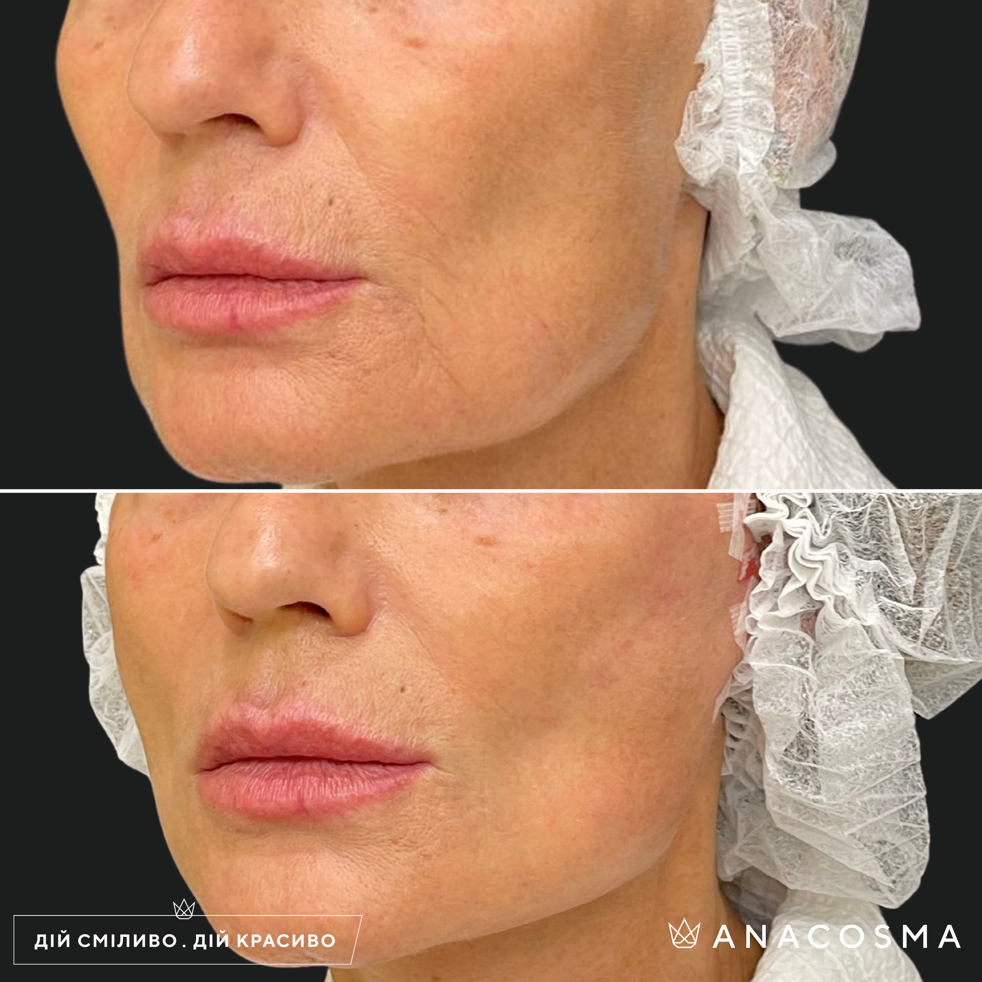 Хусід Ольга Володимирівна до і після - Фото 1