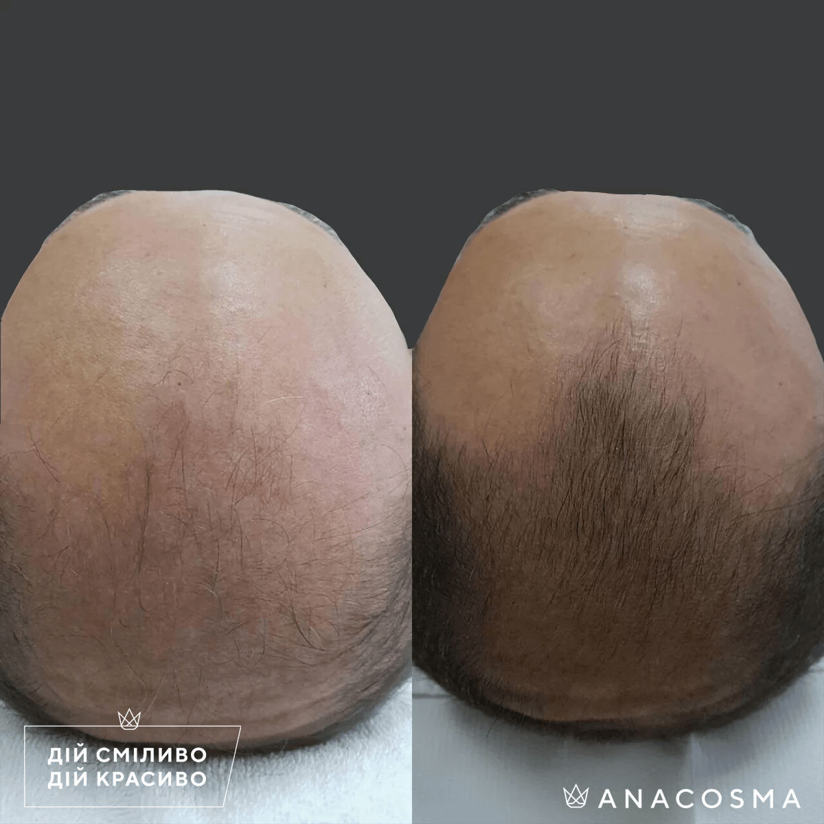 Лікування волосся до і після - Фото 2