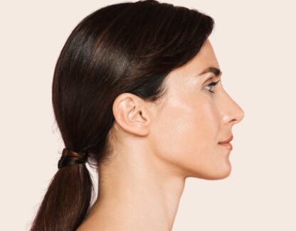 Ринопластика (пластика носа)