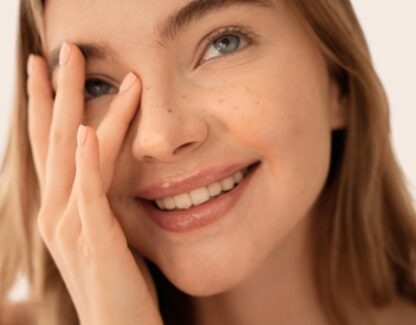 Видалення пігментних плям Cutera LimeLight