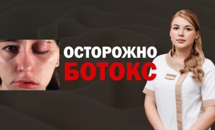 ОСЛОЖНЕНИЯ ПОСЛЕ БОТОКСА, ДИСПОРТ, КСЕОМИН ‼️💉 ПТОЗ ВЕК, ОПУЩЕНИЕ БРОВЕЙ ❌