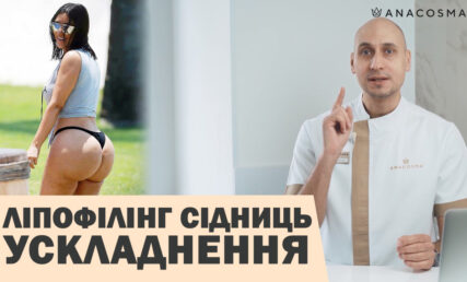 ЛІПОФІЛІНГ СІДНИЦЬ 🍑🔥 УСКЛАДНЕННЯ😱⛔ ЯК УНИКНУТИ?