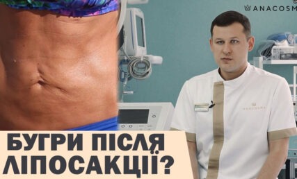 БУГРИ, НЕРІВНОСТІ ПІСЛЯ ЛІПОСАКЦІЇ ⛔️ ЩО РОБИТИ❓