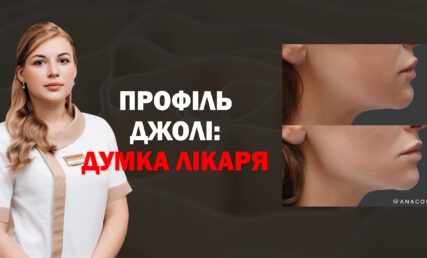 ПРОФІЛЬ ДЖОЛІ 💃🏻КОМУ ЗАБОРОНЕНІ КУТИ ДЖОЛІ?