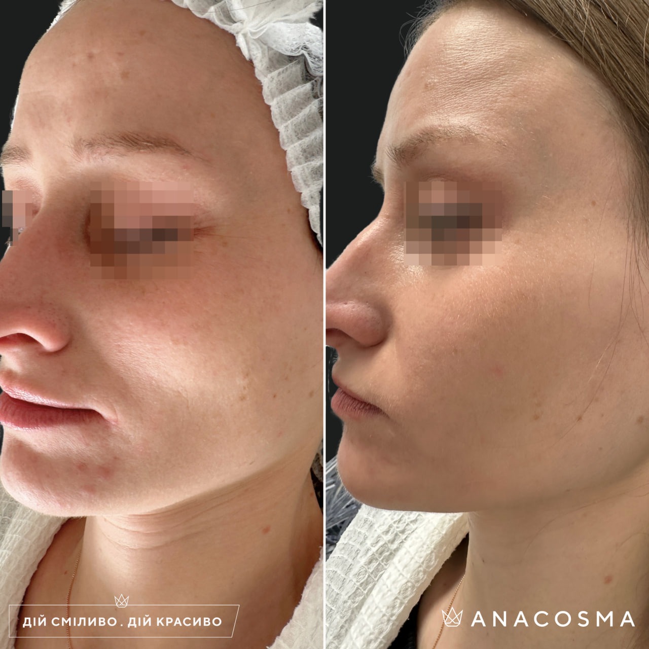 Екзосоми до і після - Фото 11