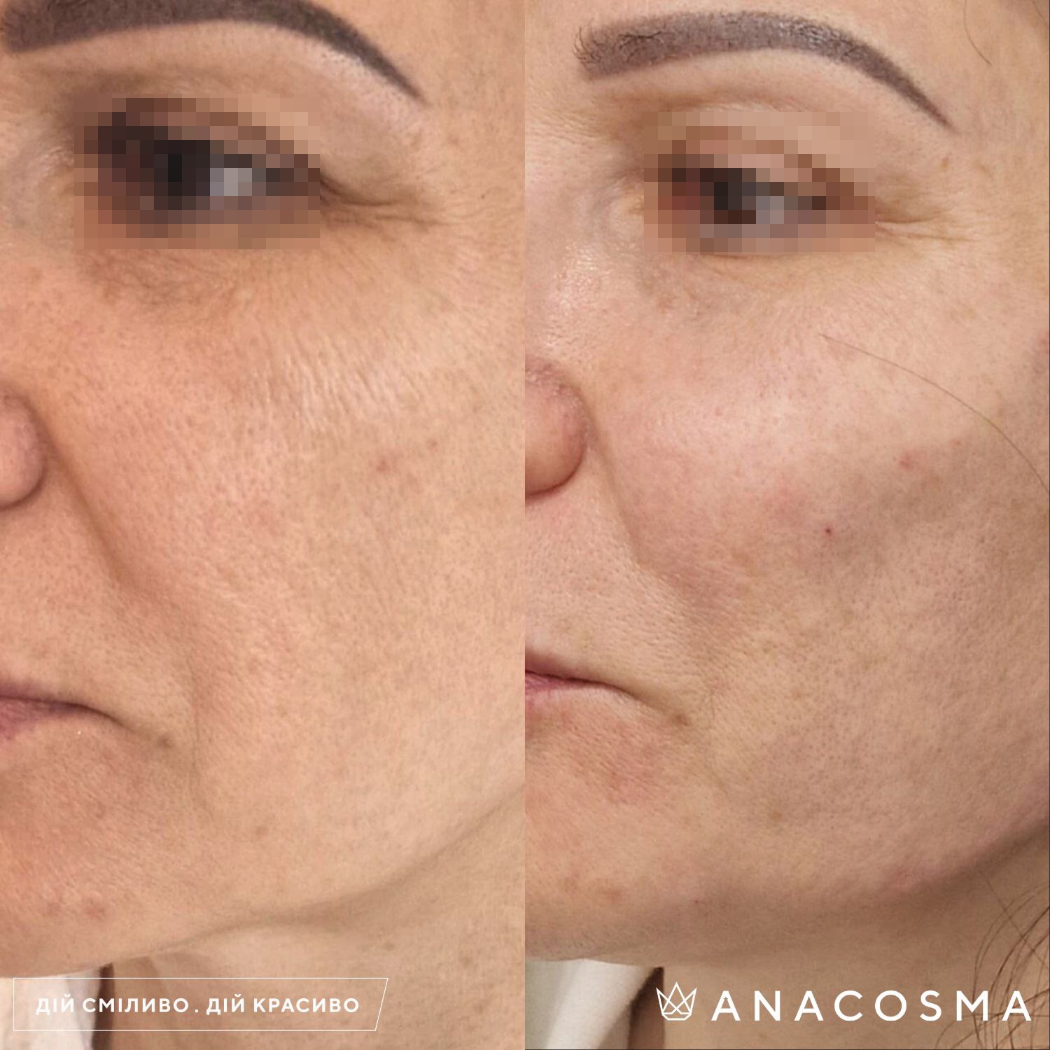 Екзосоми до і після - Фото 1