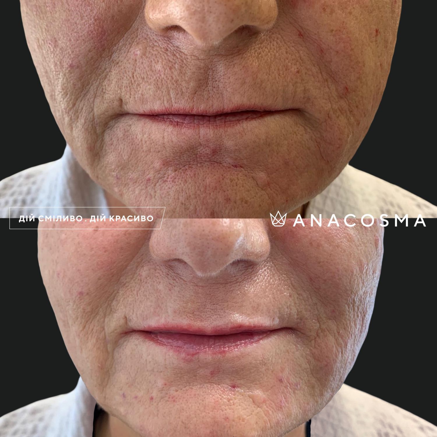 Екзосоми до і після - Фото 7