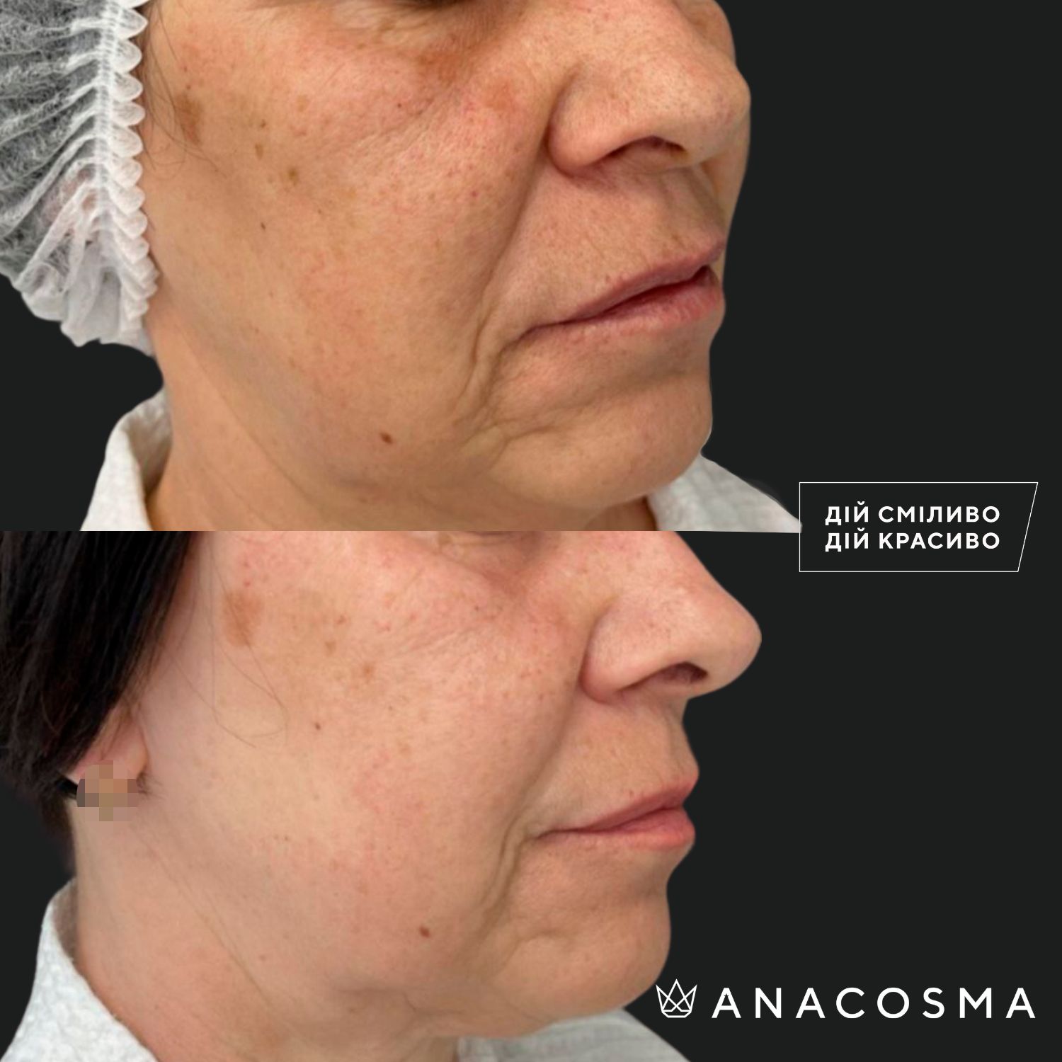 Екзосоми до і після - Фото 4