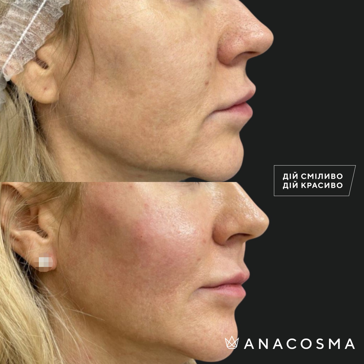 Екзосоми до і після - Фото 2