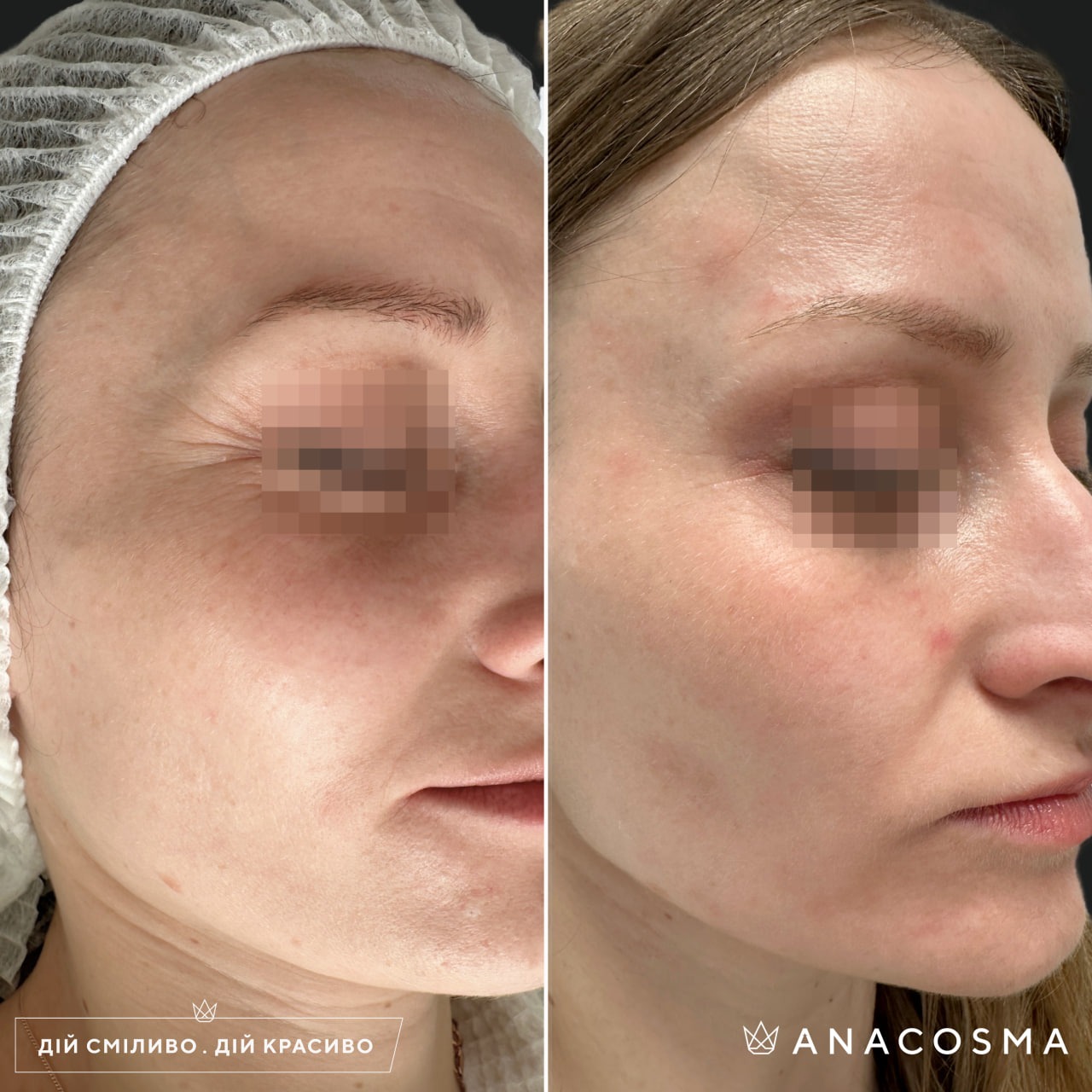 Екзосоми до і після - Фото 12