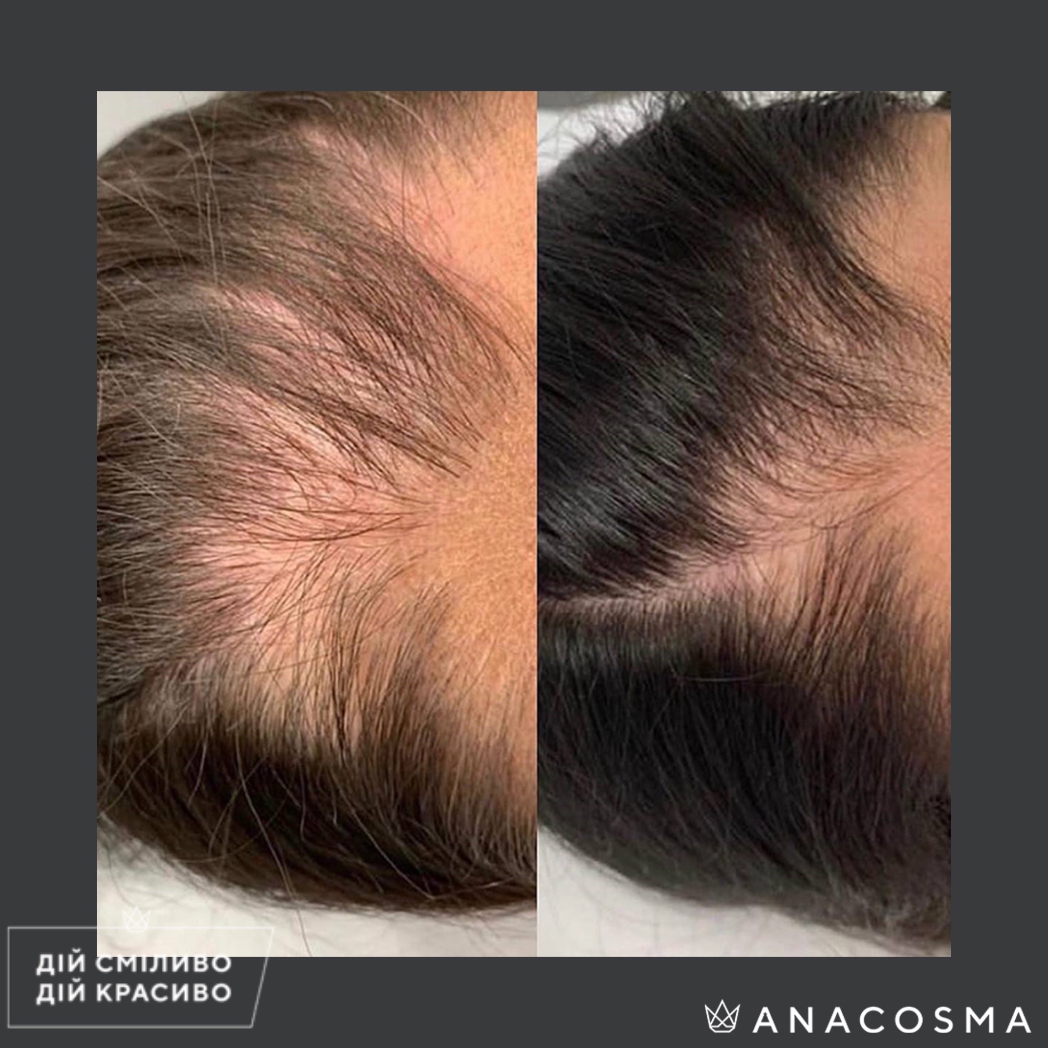 Екзосоми до і після - Фото 3