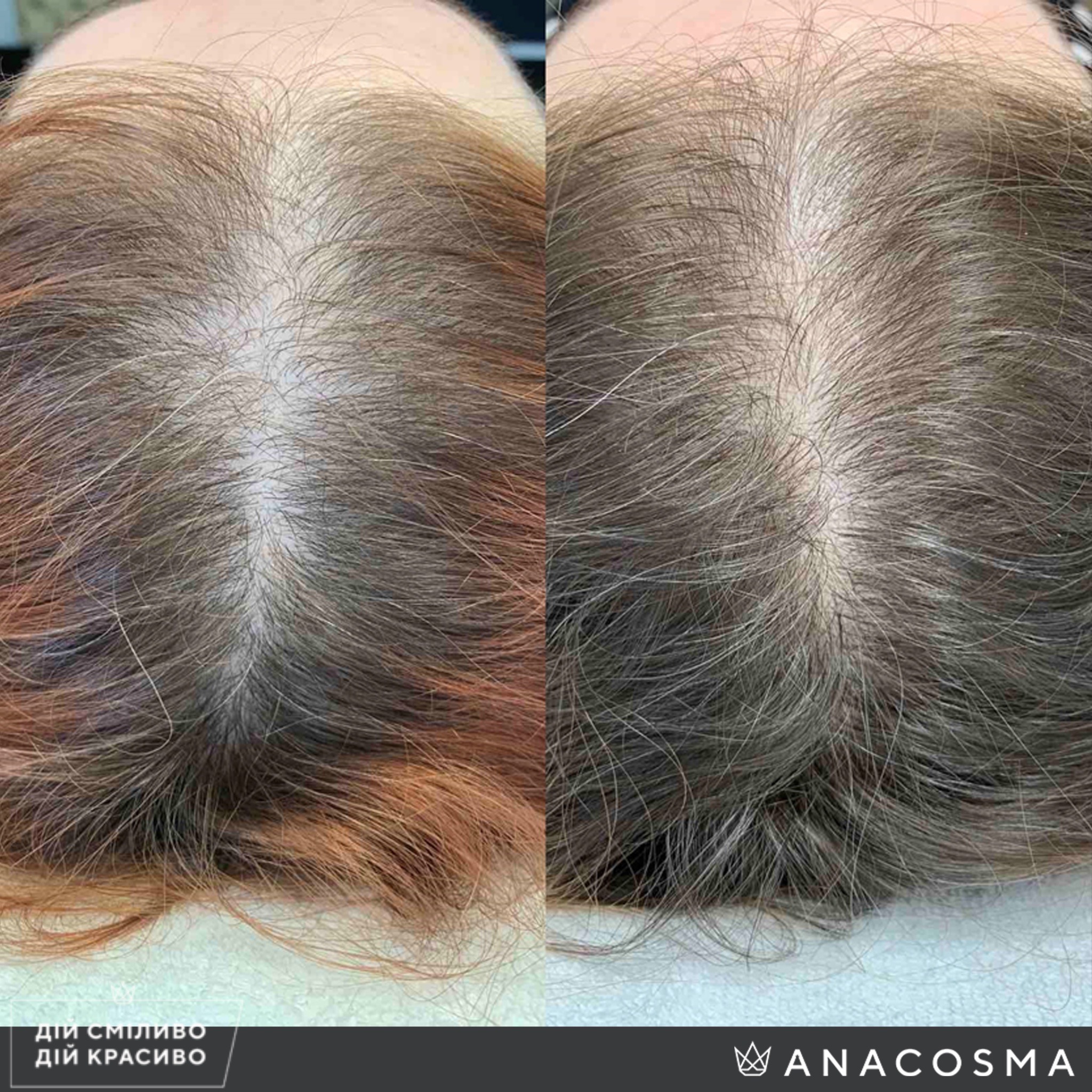 Екзосоми до і після - Фото 9