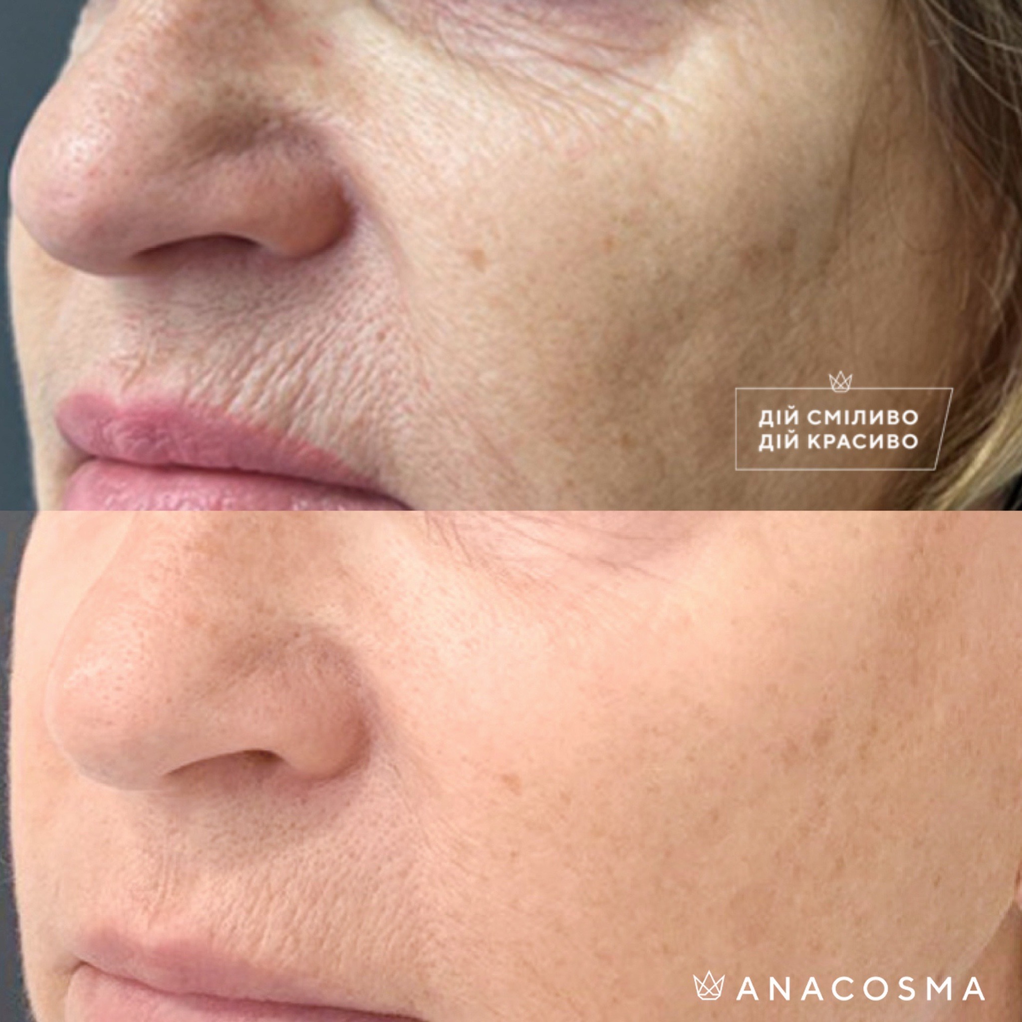 Екзосоми до і після - Фото 5