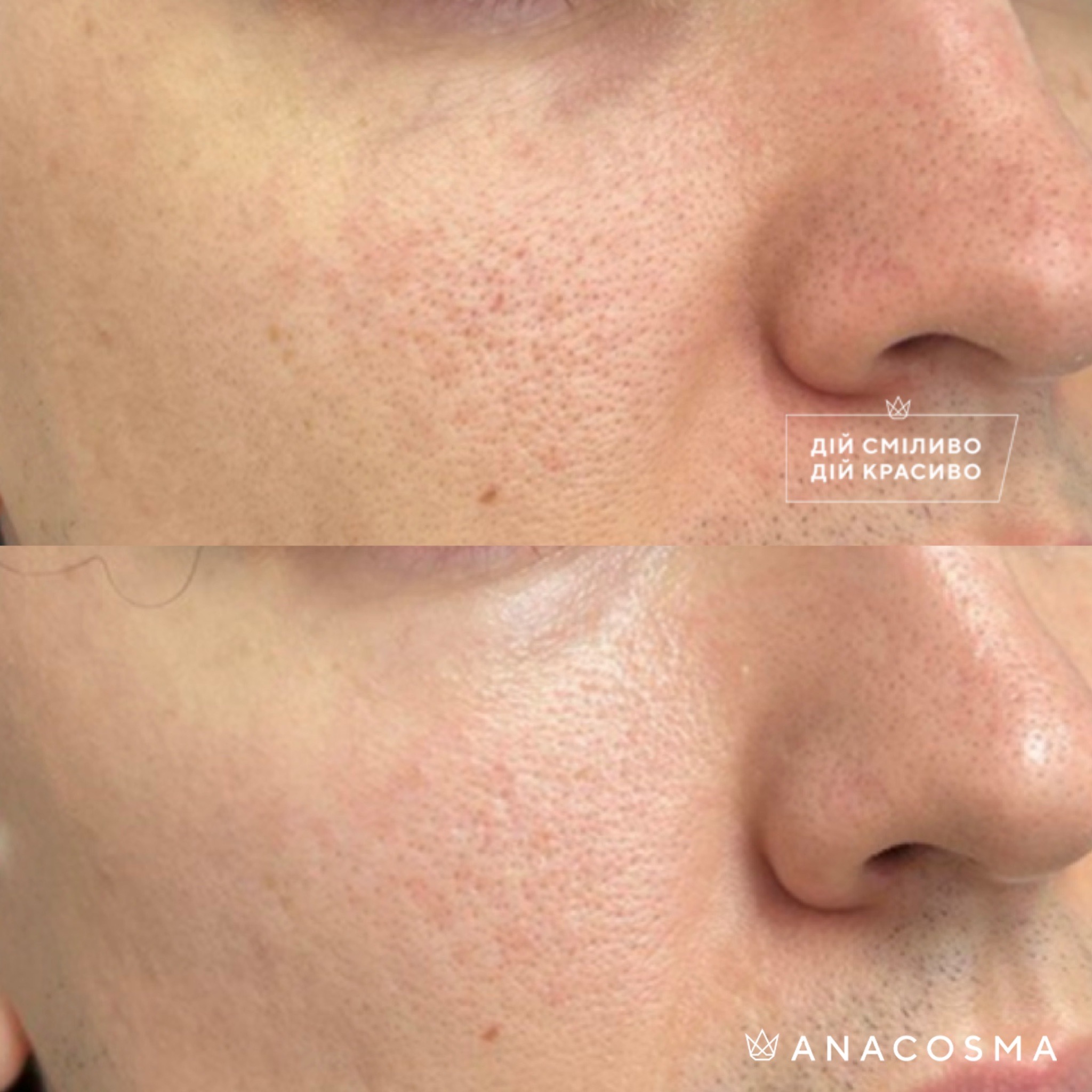 Екзосоми до і після - Фото 6