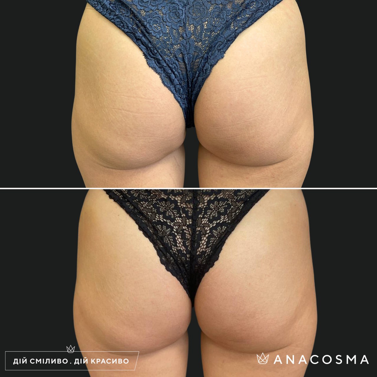 Хусід Ольга Володимирівна до і після - Фото 1