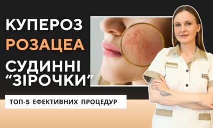 Судини на обличчі, почервоніння - ТОП-5 методів лікування